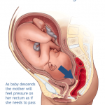 As baby moves down is gives the sensation of pressure in the bowel and sometimes as baby's head moves down squeezes and small amounts in the lower rectum out. 